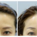 모자이크성형외과의원 이미지