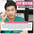 줄기세포탈모치료 잘하는곳 대영성형외과