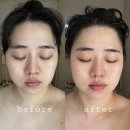 이로운에스테틱 | [뷰티] 청주 승모근 관리 산남동 이로운 에스테틱 찐 후기!