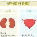 신우신염 신우신염 옆구리 통증 신우신염 신우신염 감기과 유사한 신우신염 이미지