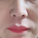 미라클다인 이미지