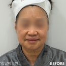 청담미의원 네이버블로그