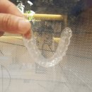 바른임플치과의원 이미지