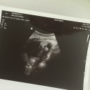 복덩이찐빵 이미지