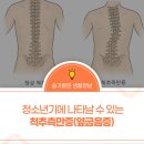 영남대학교의과대학부속 영천병원 | 청소년기에 나타날 수 있는 척추측만증(옆굽음증)