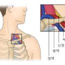 팔저림 원인 팔이 저려요 증상 저린이유 이미지