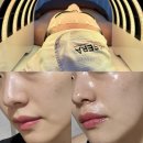 수영로 711 복합건물 | 청주피부관리 잘하는 금천동 에스테틱 미녀를그리다 온다리프팅 후기