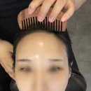모앤블레스의원 | 압구정 모앤블레스의원 두피관리샵 강남두피관리 후기