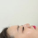 라라퀸# 이미지