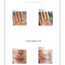 키박 이미지