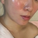 장수온누리약국 | 상도동윤곽관리 행복에스테틱 피부관리 솔직후기