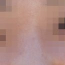 장익수성형외과 이미지