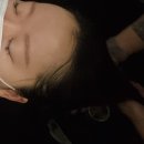 Dear.마 이 아 지 | 청주가경동머리잘하는곳 에릭마 경호점에서 클리닉 솔직후기!(비포애프터 비교샷)