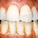 미소필치과의원 이미지