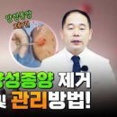 피부양성종양 적출술, 제거 시기와 주의점 이미지