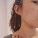 정읍유도교실 | 피부과 카프리레이저 화이트토닝 내돈내산 솔직후기