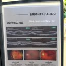 밝은힐링안과의원 이미지