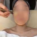 살롱드보떼 | 일산피부관리맛집 살롱드보떼 물광관리받은 후기