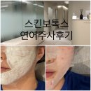 송파미소피부과의원 | 잠실새내역 피부과 베러미의원 잠실점 스킨부스터 내돈내산후기