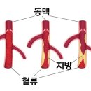 관상동맥 이란 이미지