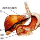 췌장암 증상과 췌장암에 좋은음식 이미지