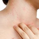 오킴스피부과의원 이미지