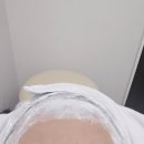 강남병원 | 강남 리쥬란 병원 후기 (모찌의원)