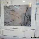 김밥천국(동원A입구) | 두피스파 스케일링으로 개운하게, 닥터모락 건대점 두피관리 후기