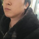 청담엔샤인의원 | 온다리프팅으로 이중턱개선 동안만들기 쳐진살 끌어올리기 압구정로데오피부과 청담엔샤인