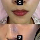 샤인메디칼 | [당감] 메디컬 에스테틱 “미샤인뷰티” 미백관리 수분관리 후기