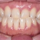 미라클치과기공소 이미지