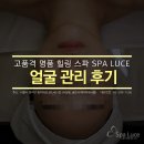 스파루체 이미지