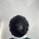 유니맘 | #두피문신후기