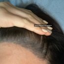 김헤어라인 이미지