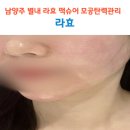 34 | 별내피부관리 라효 맥슈어 모공탄력관리 후기 모공쫀쫀 효과 추천