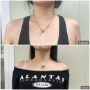 신사 상상의원에서 승모근 패키지 후기+