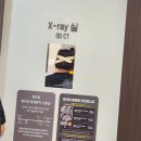 서울정플란트치과의원 Daum카페