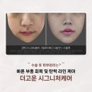 디킴스피부과의원 | 부산온천장피부과 시그니처케어로 수술 이후 부종 걱정 날려버리세요