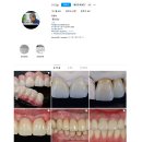 가온치과기공소 이미지