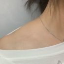 회전근개파열치료법 후기 (어깨회전근개파열증상, 회전근개 파열 수술후 회복기간,,) 이미지