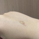 흉터연고추천 내돈내산 콘투락투벡스겔 구매후기 리얼 사용후기