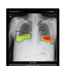 인사이트메디컬(주) 이미지