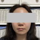 시작한 이유 보탬 알페이스(R.Face) RF 고주파 마사지기 👍내돈내산후기(일주일 사용, 🕺인터넷 면세점 구매)