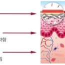 한피부