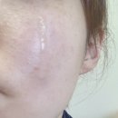 히스토리네츄어렌 HN 유산균세럼, 락토바실러스 리파인 세럼 사용해본 후기, 피부 장벽을 탄탄하게