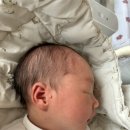 코드텍 | 아기 귀에 쥐젖 스킨텍 제거 후기와 KB손해보험 보험금지급 거절