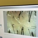 씨유 주안부성파인점 | 주안 두피스케일링 맛집 wt메소드 인천주안점 지성두피 두피케어후기