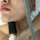 제이스오유에스테틱 | 대구피부관리 제이스오유에스테틱 , 윤곽+이중턱관리 후기