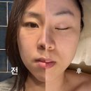 (주)센텀 | 부산 센텀피부관리 비너스고주파 후기