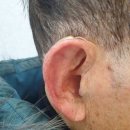 대구보청기 | 대구보청기 추천 지원금 신청 후기